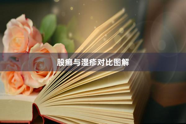 股癣与湿疹对比图解